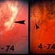 Retinal periphery showing stages of healing following infection